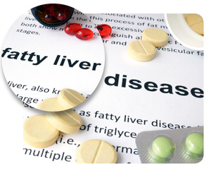 The rising incidence  of fatty liver disease and what you can do to avoid it