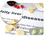 The rising incidence  of fatty liver disease and what you can do to avoid it